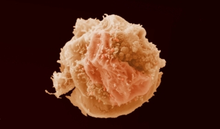 癌细胞彩色图像