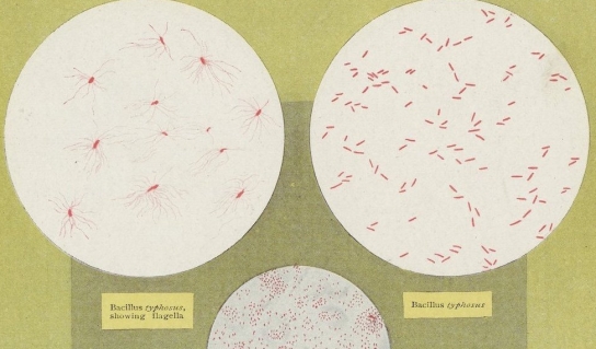 伤寒和大肠杆菌的插图